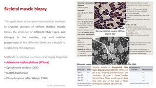 The application of enzyme histochemical methods
to cryostat sections of unfixed skeletal muscle
shows the presence of different fiber types, and
changes in the number, size and relative
proportions of the different fibers are valuable in
establishing the diagnosis
Methods in common use for muscle biopsy diagnosis:
• Adenosine triphosphatase (ATPase)
• Cytochrome oxidase (COX)
• NADH diaphorase
• Phosphorylase (after Meijer 1968)
Skeletal muscle biopsy
Normal skeletal muscle, ATPase
stain x 100
Muscle biopsy of Congenital fibre
type disproportion (CFTD). ATPase at
pH 4.63, showing predominance and
smallness of type 1 fibres (darker
fibres). Clear fibres are of type 2. Note
that only one of the type 2 fibres
belongs to subtype 2B (asterisk).
KS_JRC_Histochemistry
 