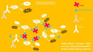 SIGNAL AMPLIFICATION
HRP
DAB
DAB
Avidin
Biotin/Streptavidin
20 Ab
10 Ab
Avidin–Biotin Complex (ABC)
and the Labeled/Streptavidin–
Biotin (LSAB) staining methods
 