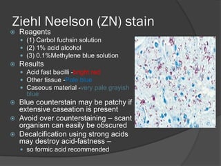 Caseation Hitopath Comprehensive Overview of Histochemistry and Cytochemistry Techniques ...
