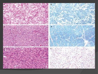 Histochemistry in Pathology | PPTX