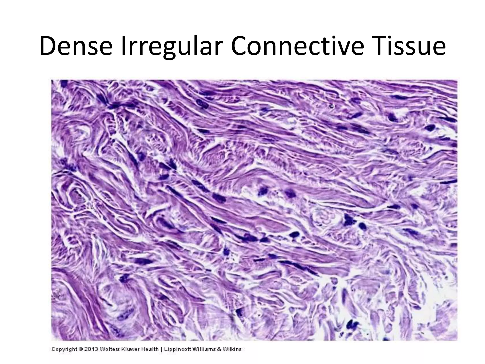 Dense Irregular Connective Tissue
 