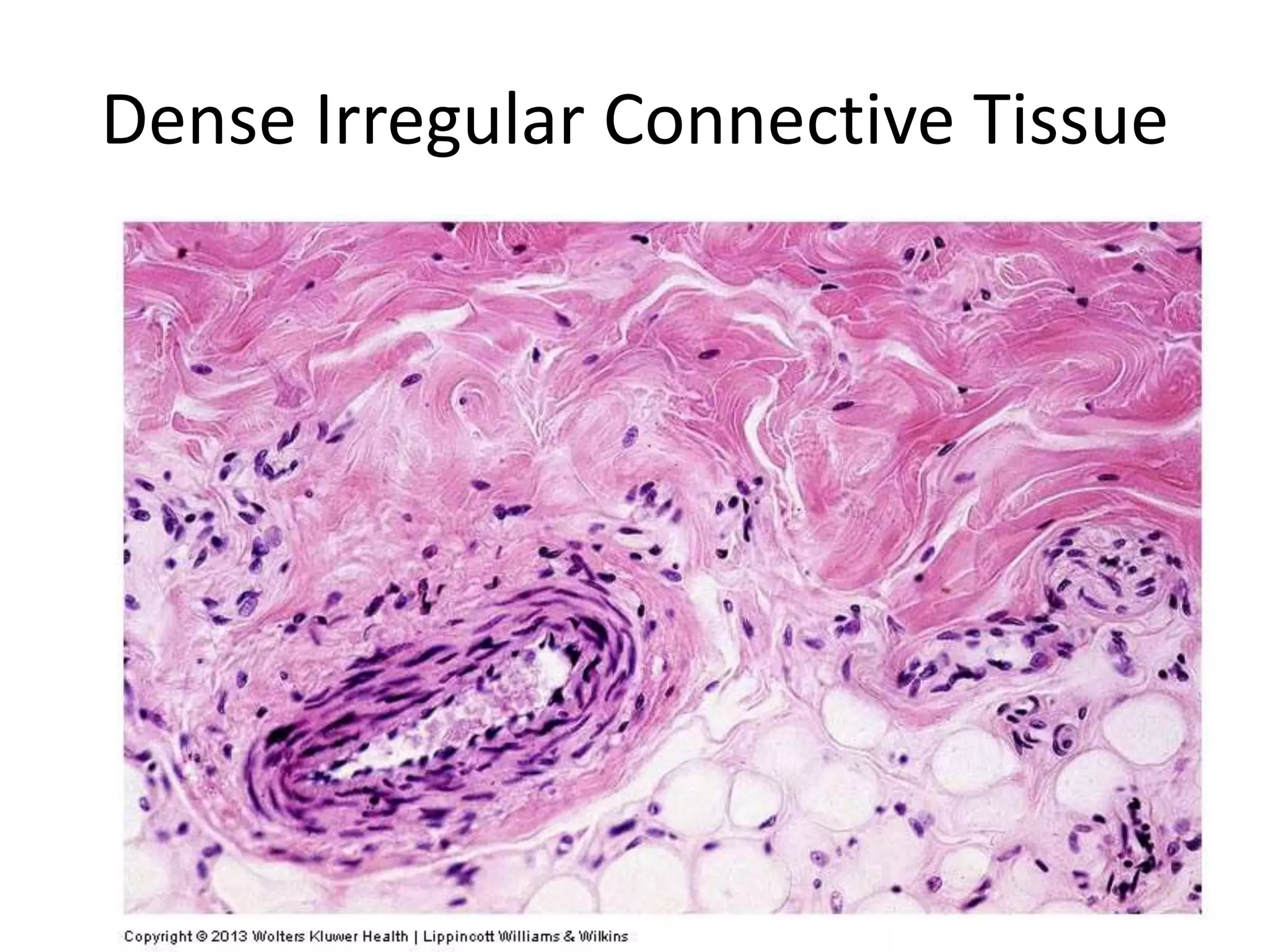 Dense Irregular Connective Tissue
 