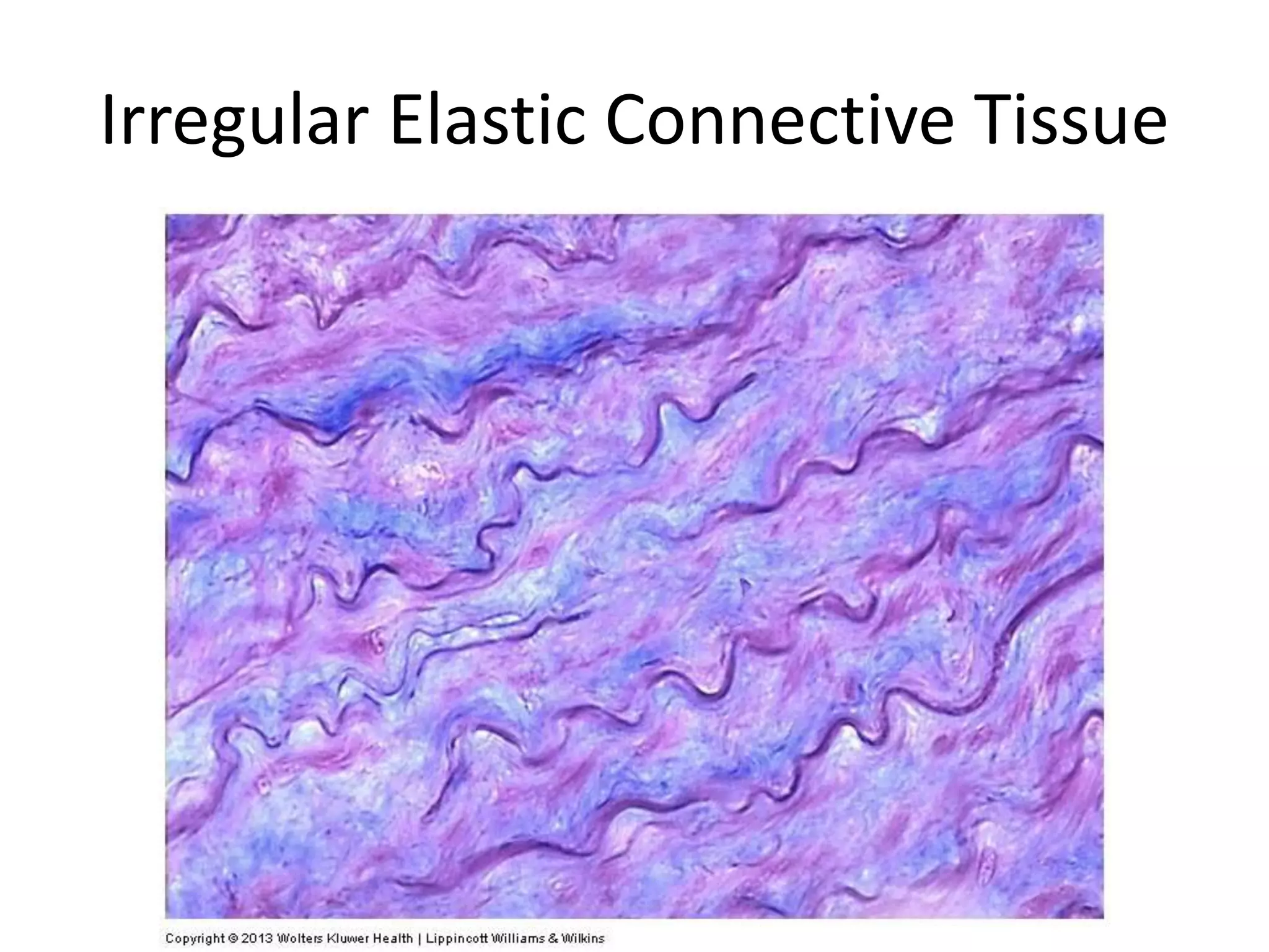 Irregular Elastic Connective Tissue
 