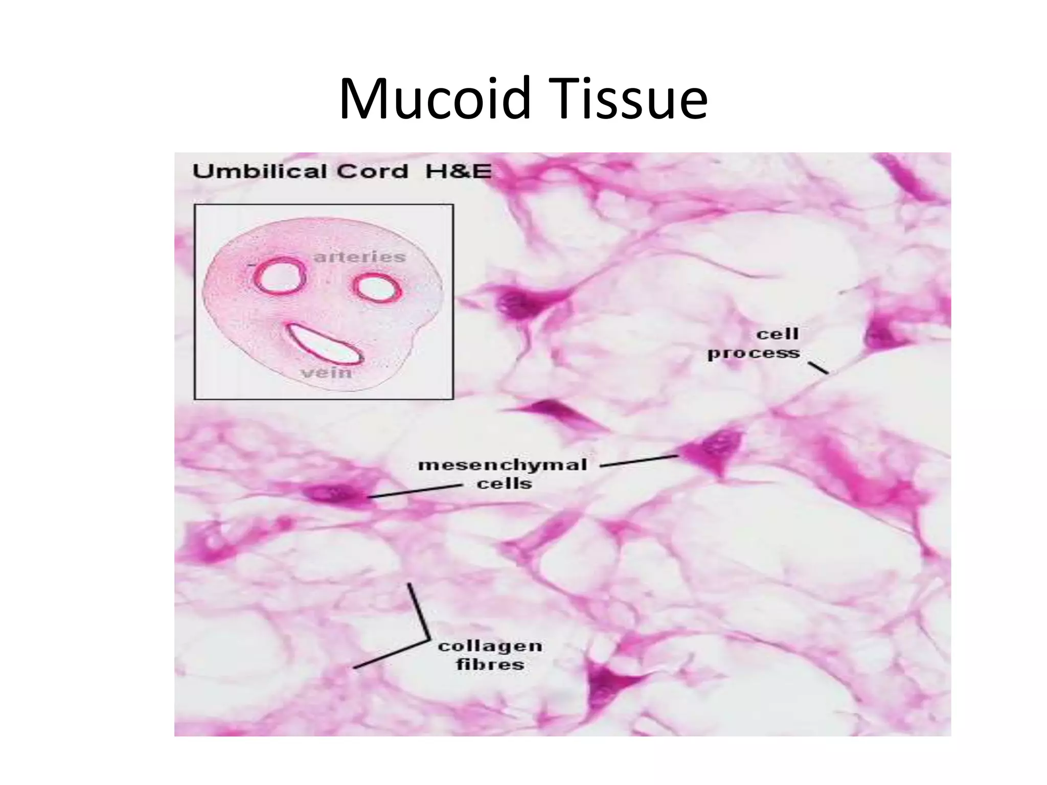 Mucoid Tissue
 