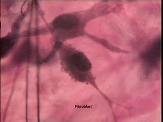 Fibroblast
 