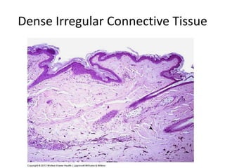 Dense Irregular Connective Tissue
 