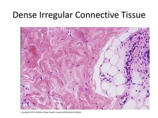 Dense Irregular Connective Tissue
 