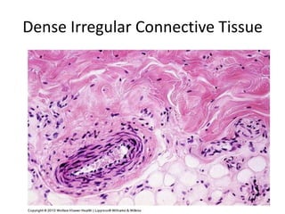Dense Irregular Connective Tissue
 