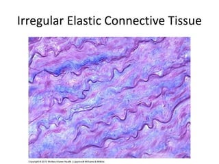 Irregular Elastic Connective Tissue
 