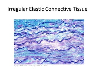 Irregular Elastic Connective Tissue
 