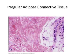 Irregular Adipose Connective Tissue
 