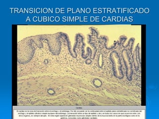 TRANSICION DE PLANO ESTRATIFICADO
A CUBICO SIMPLE DE CARDIAS
 
