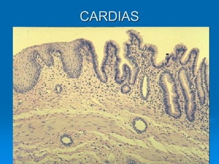 CARDIAS
 