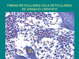 FIBRAS RETICULARES CELS RETICULARES
DE GANGLIO LINFATICO
 