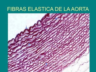 FIBRAS ELASTICA DE LA AORTA
 