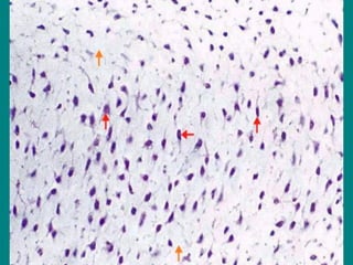 TEJIDO MESENQUIMAL
CELULAS MESENQUIMALES EN
MATRIZ MESENQUIMAL
 