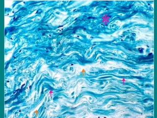 FIBRAS COLAGENAS SUSTANCIA
FUNDAMENTAL TEJIDO CONECTIVO DE
GLANDULA MAMARIA
 