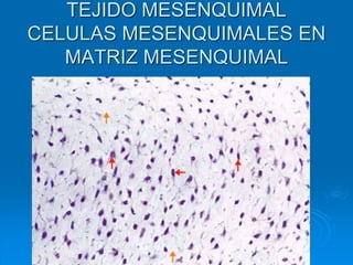 TEJIDO MESENQUIMAL
CELULAS MESENQUIMALES EN
MATRIZ MESENQUIMAL
 