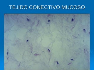 TEJIDO CONECTIVO MUCOSO
 