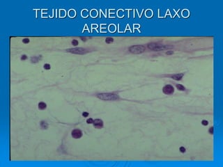 TEJIDO CONECTIVO LAXO
AREOLAR
 