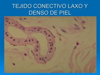 TEJIDO CONECTIVO LAXO Y
DENSO DE PIEL
 