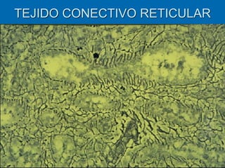 TEJIDO CONECTIVO RETICULAR
 
