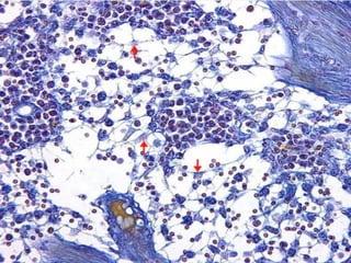 FIBRAS RETICULARES CELS RETICULARES
DE GANGLIO LINFATICO
 