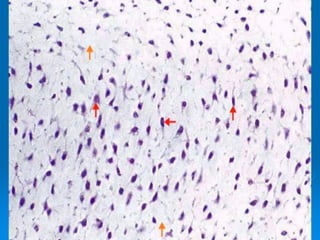 TEJIDO MESENQUIMAL
CELULAS MESENQUIMALES EN
MATRIZ MESENQUIMAL
 