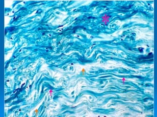 FIBRAS COLAGENAS SUSTANCIA
FUNDAMENTAL TEJIDO CONECTIVO DE
GLANDULA MAMARIA
 