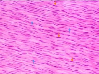 FIBRAS COLAGENAS DE
TENDON Y FIBROBLASTOS
 