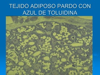 TEJIDO ADIPOSO PARDO CON
AZUL DE TOLUIDINA
 