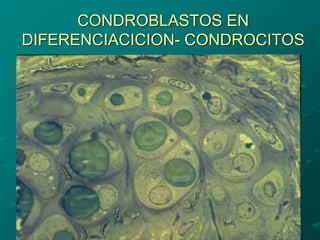 CONDROBLASTOS EN
DIFERENCIACICION- CONDROCITOS
 
