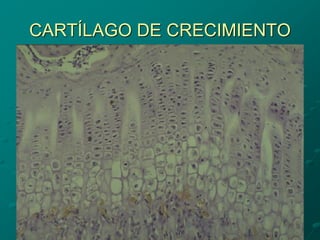 CARTÍLAGO DE CRECIMIENTO
 