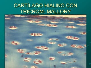 CARTÍLAGO HIALINO CON
TRICROM- MALLORY
 