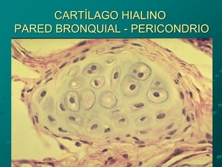 CARTÍLAGO HIALINO
PARED BRONQUIAL - PERICONDRIO
 
