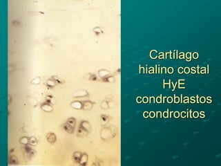 Cartílago
hialino costal
HyE
condroblastos
condrocitos
 