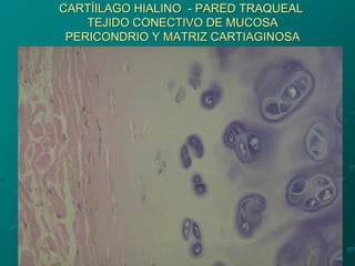 CARTÍILAGO HIALINO - PARED TRAQUEAL
TEJIDO CONECTIVO DE MUCOSA
PERICONDRIO Y MATRIZ CARTIAGINOSA
 