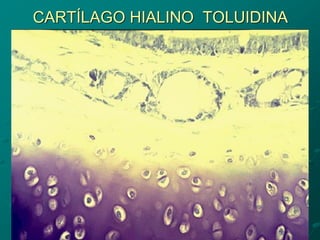 CARTÍLAGO HIALINO TOLUIDINA
 