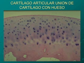 CARTÍLAGO ARTICULAR UNION DE
CARTÍLAGO CON HUESO
 