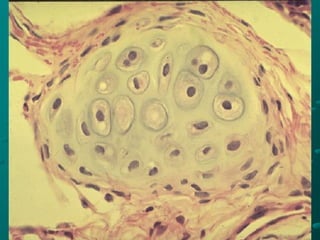 CARTILAGO HIALINO
PARED BRONQUIAL - PERICONDRIO
 