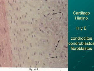 Cartílago
Hialino
H y E
condrocitos
condroblastos
fibroblastos
 