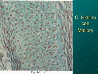 C. Hialino
con
Mallory
 