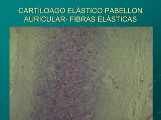 CARTÍLOAGO ELÁSTICO PABELLON
AURICULAR- FIBRAS ELÁSTICAS
 