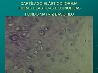 CARTÍLAGO ELÁSTICO- OREJA
FIBRAS ELÁSTICAS EOSINOFILAS
FONDO MATRIZ BASÓFILO
 