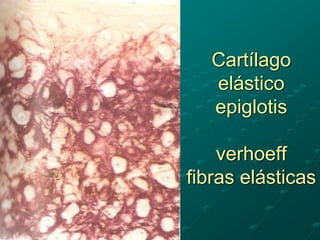 Cartílago
elástico
epiglotis
verhoeff
fibras elásticas
 