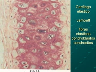 Cartílago
elástico
verhoeff
fibras
elásticas
condroblastos
condrocitos
 