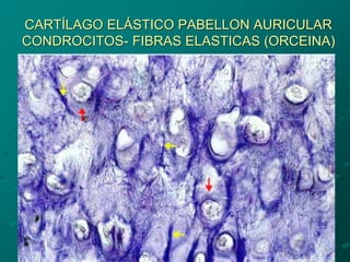 CARTÍLAGO ELÁSTICO PABELLON AURICULAR
CONDROCITOS- FIBRAS ELASTICAS (ORCEINA)
 