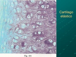 Cartílago
elástico
 