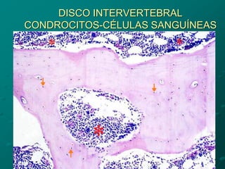 DISCO INTERVERTEBRAL
CONDROCITOS-CÉLULAS SANGUÍNEAS
 