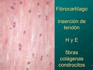 Fibrocartílago
inserción de
tendón
H y E
fibras
colágenas
condrocitos
 